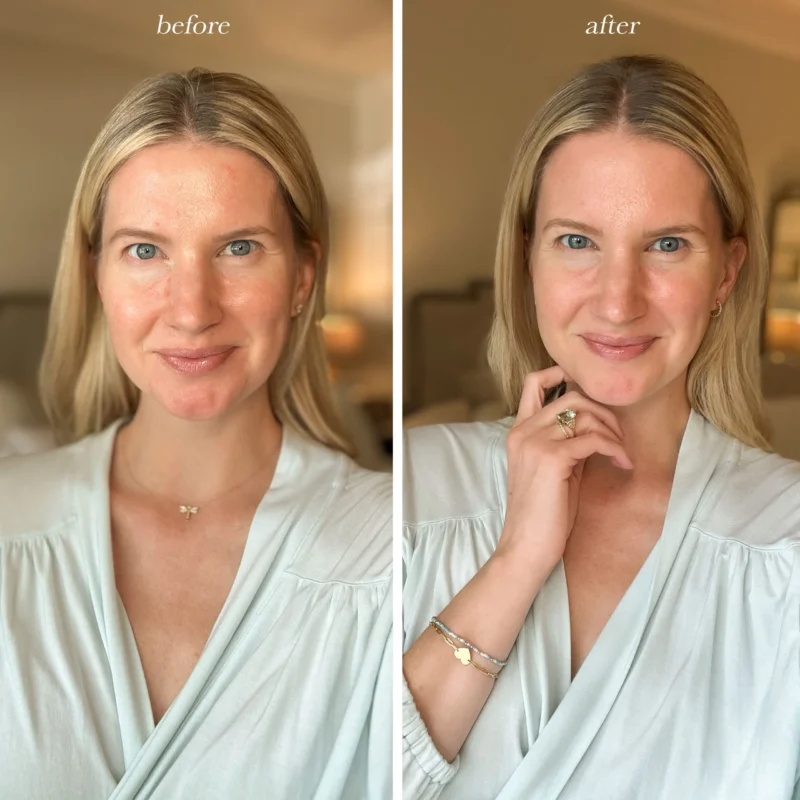 "Woman using VEVOR 3-in-1 facial wand for red light therapy, vibration massage, and heat treatment on face"