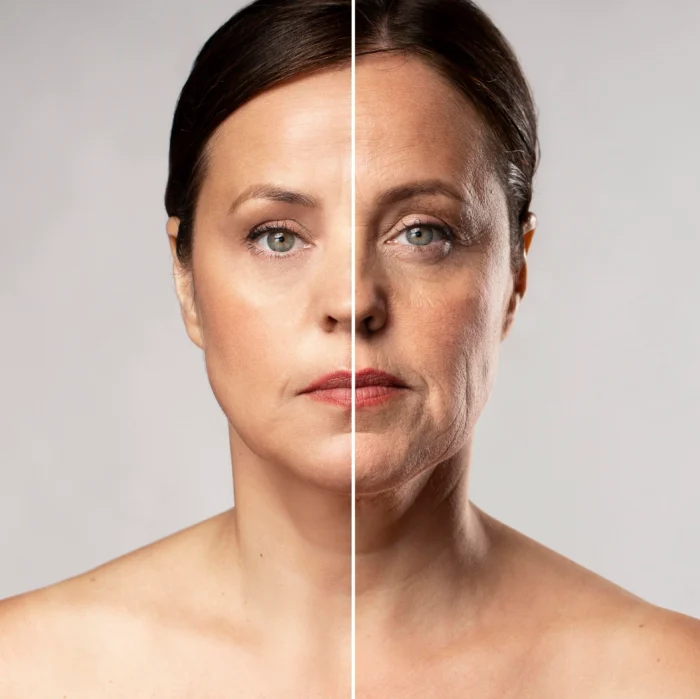 Before and after portrait of mature woman showing anti-aging skin transformation