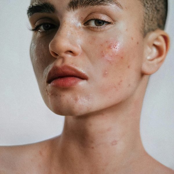 Clear and Glowing Skin After Skincare Routine Woman with Radiant, Healthy Skin – Post-Skincare Glow